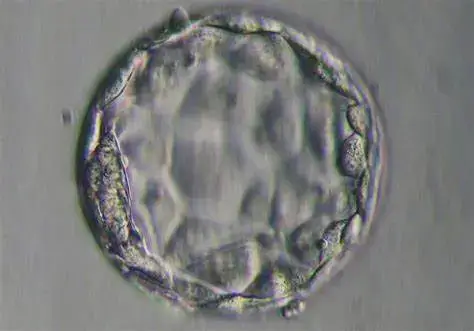 Blastocisti ingrandita al microscopio